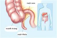 Những triệu chứng đau ruột thừa cần lưu ý để tránh nguy hiểm