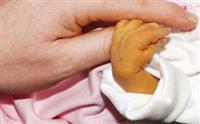 Da vàng là bệnh gì? Làm cách nào để chữa trị