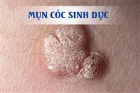 15 nguyên nhân chính dẫn đến ngứa hậu môn