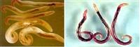 Nghiên cứu ca lâm sàng: Bệnh ấu trùng di chuyển dưới da do gnathostoma spinigerum tại Viện Sốt rét – Ký sinh trùng – Côn trùng Trung ương năm 2018