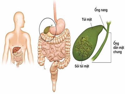 da vàng là biểu hiện của bệnh gì