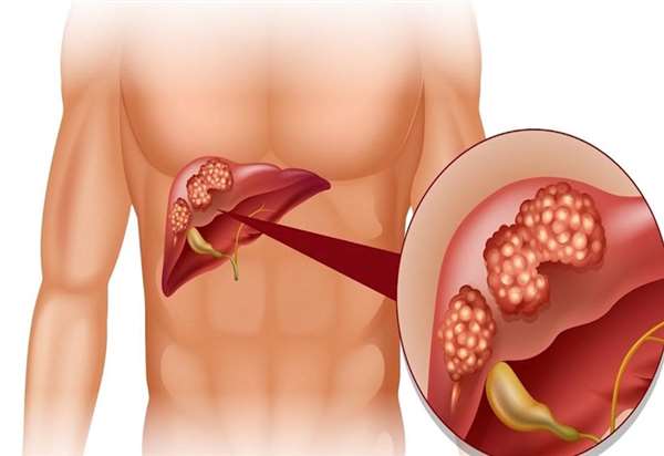 Mách bạn cách khắc phục hiện trạng bị ngứa khắp người không rõ nguyên do.