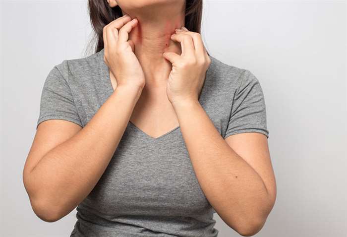 Bị ngứa khắp người không rõ nguyên cớ phải làm sao?