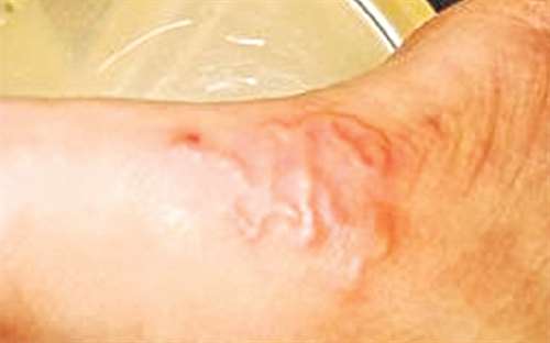 Xét Nghiệm Ký Sinh Trùng Trong Máu.