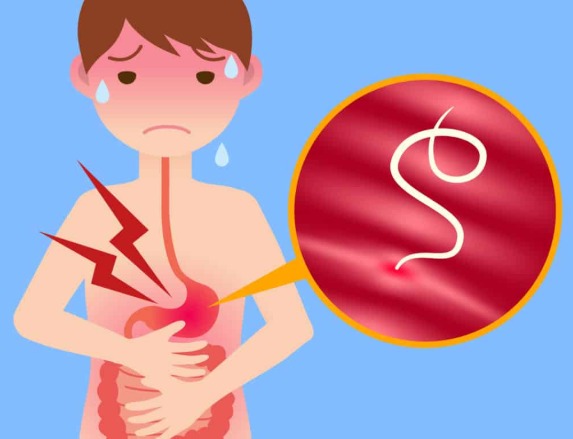 Đau bụng giun ở vị trí nào?