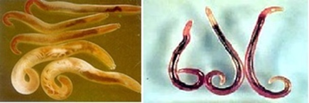 Nghiên cứu ca lâm sàng: Bệnh ấu trùng di chuyển dưới da do gnathostoma spinigerum tại Viện Sốt rét – Ký sinh trùng – Côn trùng Trung ương năm 2018